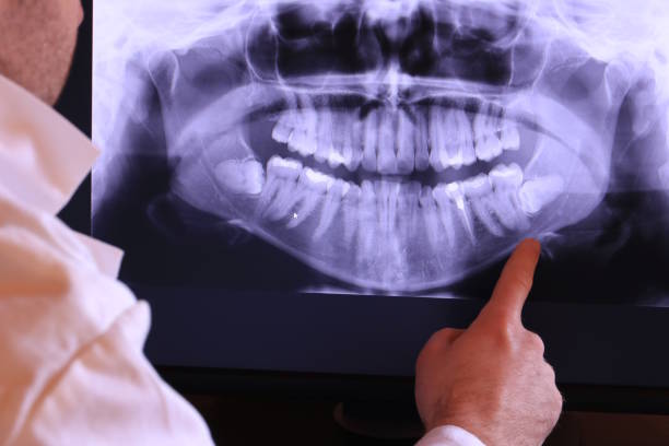 Best Emergency Dental Care for Trauma or Injury in Carthage, NC